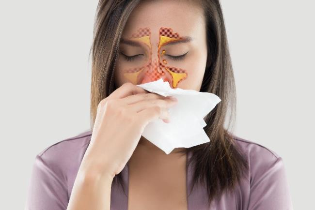 אישה מקנחת את אפה וסובלת מכאב באזור הסינוסים שעלול להעיד על סינוסיטיס